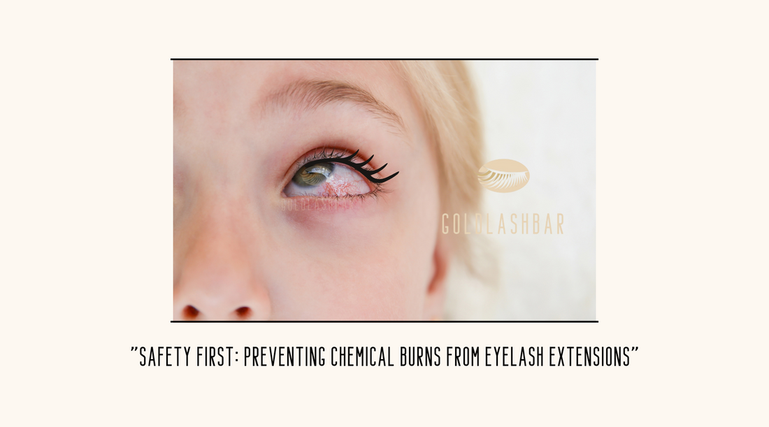 Safety First: Preventing Chemical Burns from Eyelash Extensions